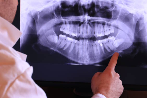 Best Broken or Cracked Tooth Emergency Dentist in Riverton, NJ